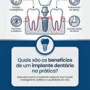 Quais são os benefícios de um implante dentário na prática?