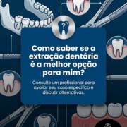 Como saber se a extração dentária é a melhor opção para mim?