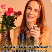 As lentes de contato dentais precisam ser tão brancas?