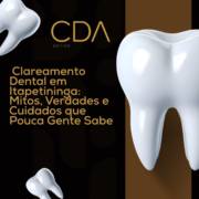Clareamento Dental em Itapetininga: Mitos, Verdades e Cuidados que Pouca Gente Sabe