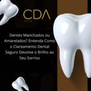 Dentes Manchados ou Amarelados? Entenda Como o Clareamento Dental Seguro Devolve o Brilho ao Seu Sorriso