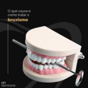 O que causa e como tratar o Bruxismo?