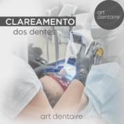 Quanto tempo dura clareamento dental?