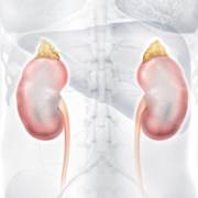 O papel da água na prevenção ao cálculo renal