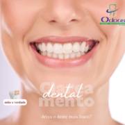 Clareamento Dental