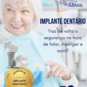 Implantes Dentários