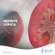 NEFRITE LÚPICA