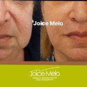 Estética facial!