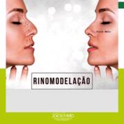 Rinomodelação: nariz mais bonito naturalmente!