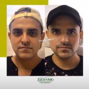 Estética masculina!