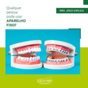 Qualquer pessoa pode usar aparelho fixo?