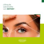 Lifting de sobrancelha com botox?