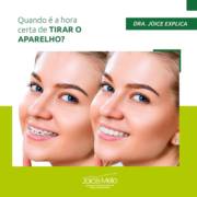 Quando é a hora certa de tirar o aparelho?