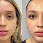 Mais Jovem, Mais Bonita, Mais Você – Com a Clínica Joice Melo!