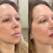Realce sua beleza na Clínica Joice Melo em Mineiros