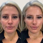 Beleza com naturalidade e equilíbrio, só aqui na Joice Melo em Mineiros