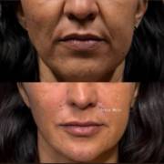 Estética e qualidade andam juntas: vem para a Clínica Joice Melo