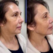 Realçando sua beleza com naturalidade