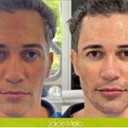 Homens também podem cuidar da estética na Clínica Joice Melo