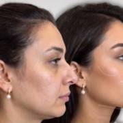 Beleza facial com naturalidade e confiança em Mineiros