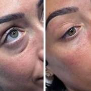 Procedimentos faciais pensados para realçar o que você já tem de melhor