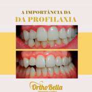 A importância da Profilaxia!