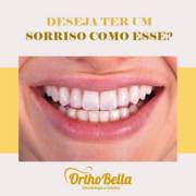 Deseja ter um sorriso como esse?