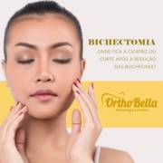Bichectomia