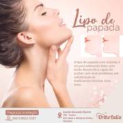 Lipo na papada
