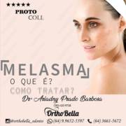 Melasma