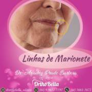 Linhas de marionetes