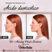 O que é o ácido deoxicólico?