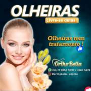 Olheiras tem tratamento!