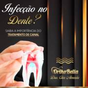 A importância do tratamento de canal