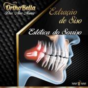 Por que é importante fazer a extração de siso?