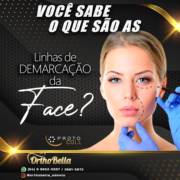 Linhas de demarcação da face