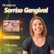 Dê adeus ao sorriso gengival!