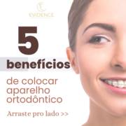 5 benefícios de usar aparelho ortodôntico: mais que estética, é saúde