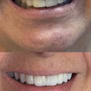 Sorriso alinhado, natural e cheio de confiança