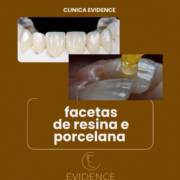 Sorriso renovado, autoestima lá em cima - Conheça os serviços da Evidence