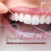 Afinal, devo usar fio dental antes ou depois da escovação?