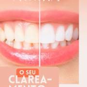 Clareamento Dental em Mineiros para um sorriso mais branco e saudável