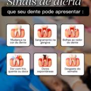 Fique atento aos sinais que seu sorriso pode apresentar