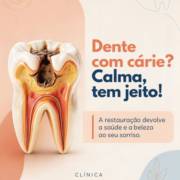 Dente com cárie? Calma que tem solução em Mineiros!