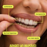 Aparelho invisível Sou Smile: transforme seu sorriso com discrição