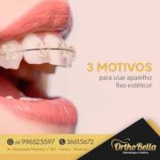 3 Motivos para usar aparelho fixo estético