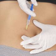 Aplicação de Enzimas - Intradermoterapia