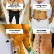 Benefícios da Ventosaterapia