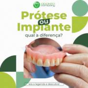 Prótese ou implante, qual na diferença?