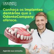 Conheça os implantes dentários que a Odonto Company oferece.